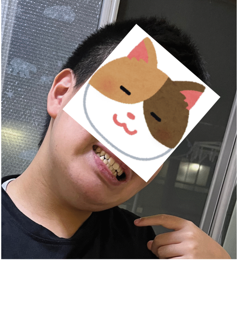 きれいな歯のJ君